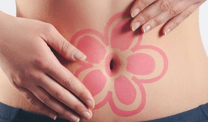 APE_Endometriosi1 endometriosi